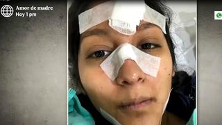 Ciclista denuncia haber sufrido accidente por un bache en la bajada Sucre, en Magdalena (VIDEO)