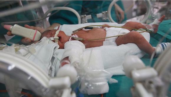 Bebés prematuros corren más riesgo de morir y cifras van en aumento (VIDEO)