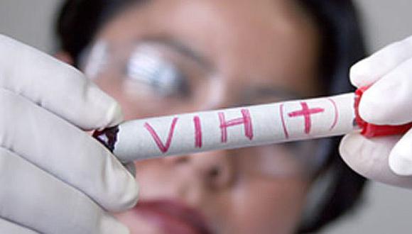 Piura: El 97% de casos de VIH se contagiaron por la vía sexual
