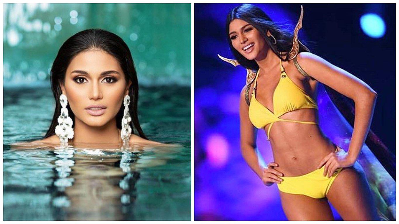 Cirujano muestra cómo era Miss Venezuela antes de someterse a cirugías plásticas (FOTOS)