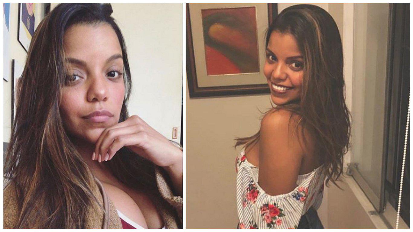 Johana Cubillas revela con original tatuaje que padece de una enfermedad de la piel (FOTO)