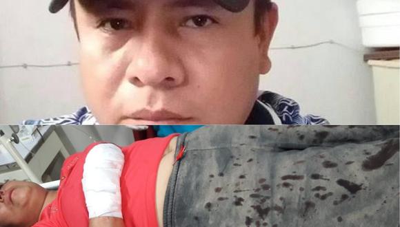 Obrero golpea y acuchilla a su esposa en el distrito de Tumán (VIDEO)