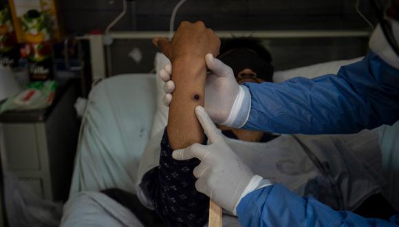 Los casos confirmados en laboratorio se elevan a 41.664 en 96 países y se han reportado doce muertes. (Foto: AFP)