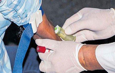 Identifican  275 nuevos casos de VIH en la región Ayacucho