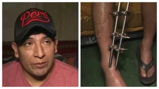 Danzante de tijeras asegura que se siente abandonado tras fracturarse la pierna (VIDEO)