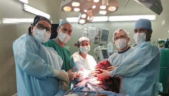 Médicos del hospital Goyeneche extraen tumor de 17 kilos a una mujer de 40 años