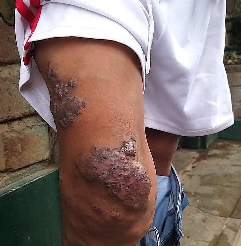 Algunas de estas enfermedades son incurables y solo son tratadas para contrarrestar sus efectos. 