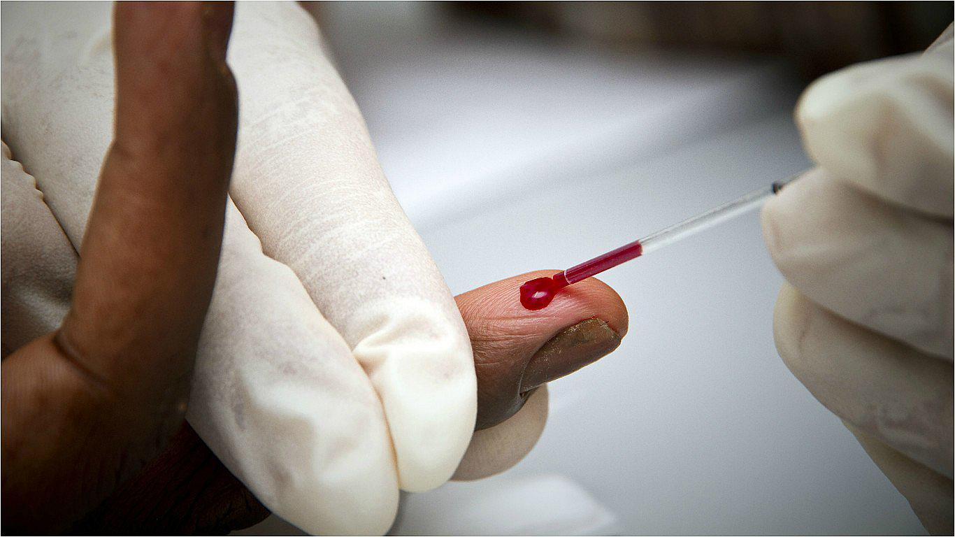 Conoce la historia del primer hombre que se curó del VIH