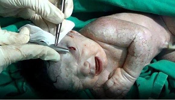 Nace en Siria una bebé con heridas de metralleta en la cabeza (VIDEO)