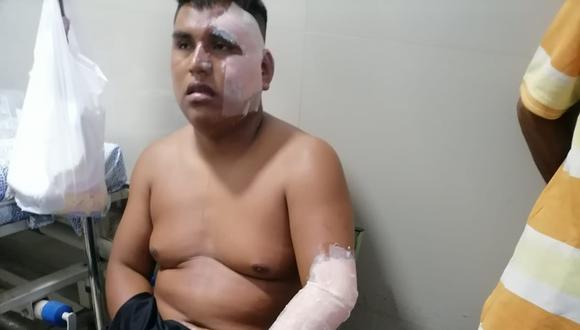 Hasta el servicio de emergencia del hospital Las Mercedes fue trasladado Jorge Sánchez Cotrina, quien fue atendido por los médicos de turno, por las múltiples heridas que presentaba.