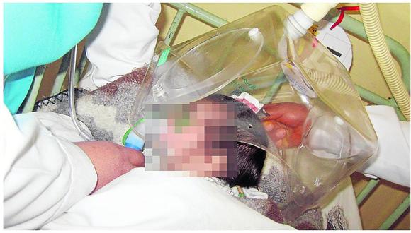 ​13 niños que no fueron tratados en hospital fallecen con neumonía 