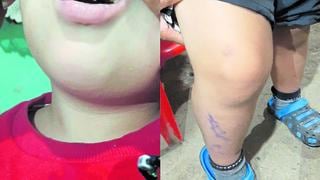 Escolar de 6 años de edad es golpeado en colegio San José