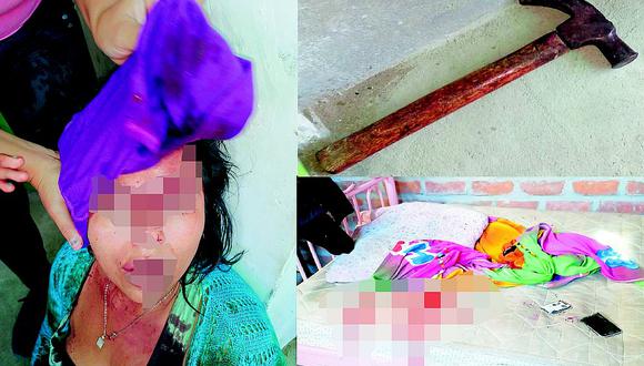 Sullana: Obrero ataca a martillazos a su pareja y la deja grave