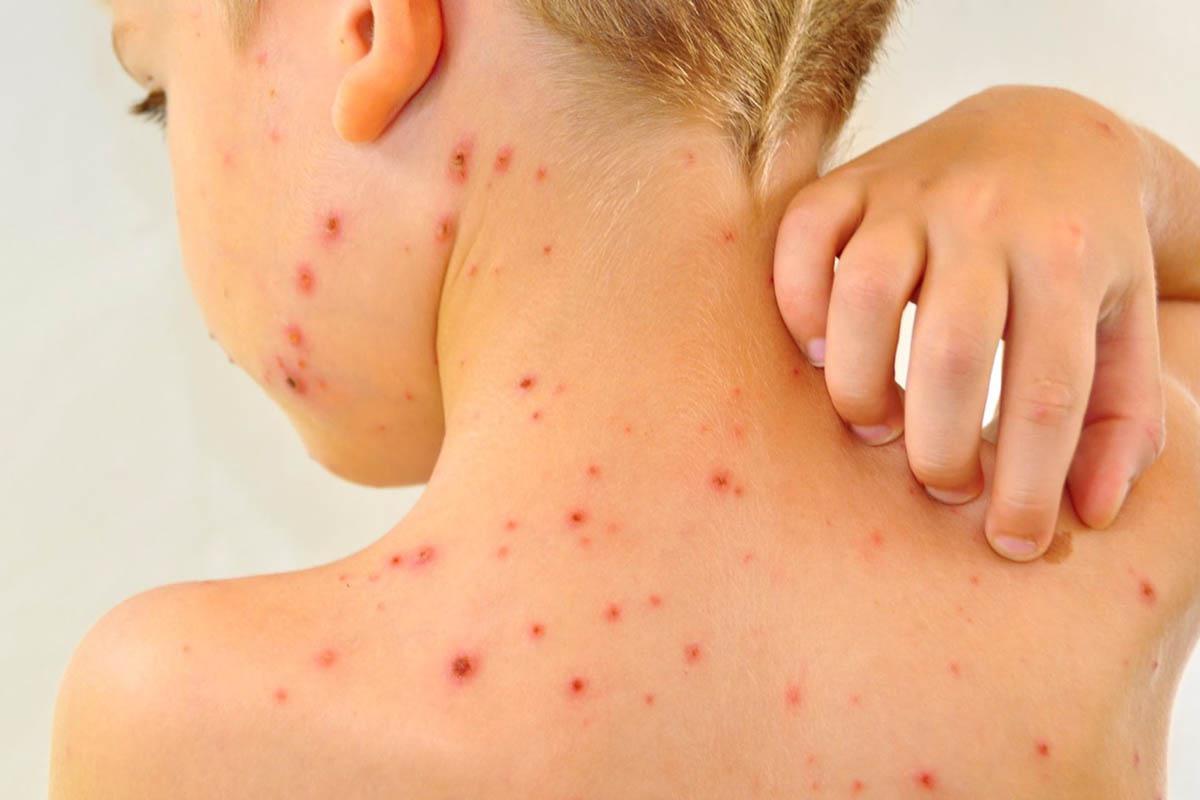 Alrededor del 7% de la población mundial padece de enfermedades raras. | Foto: Difusión