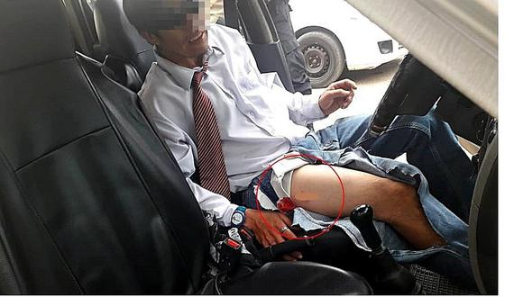 Taxista sale en defensa de su pasajera y maleantes le disparan en la pierna 