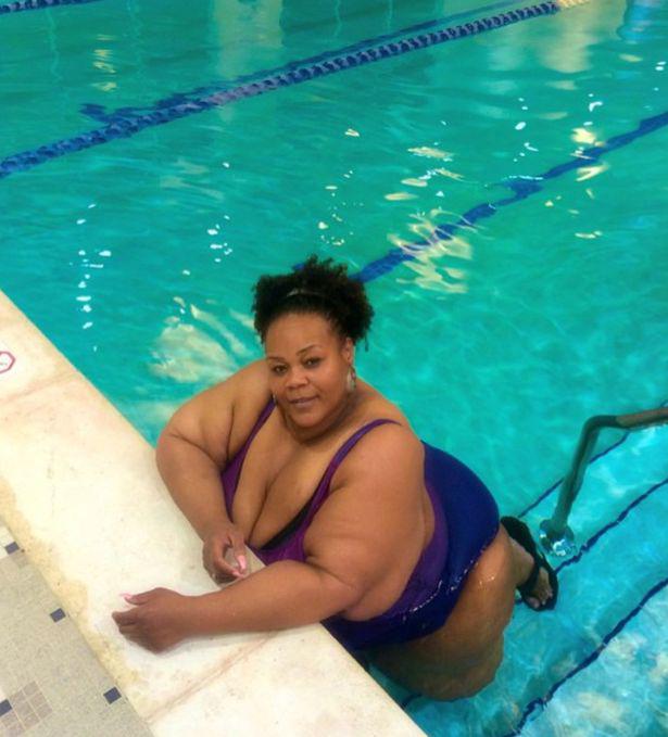 Así quedó su cuerpo tras someterse a tratamiento milagroso que le hizo perder 230 kilos 