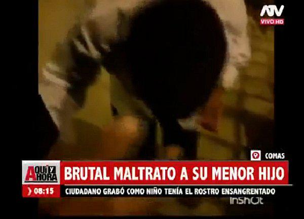 ​Comas: Padre golpea a su hijo de 4 años hasta hacerlo sangrar 