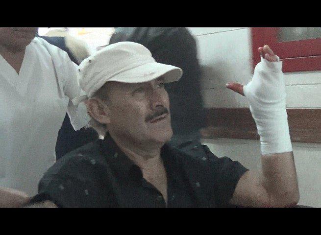 Carnicero está a punto de perder la mano tras corte con sierra