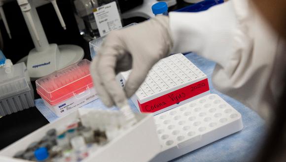 Científicos peruanos busca elaborar vacuna contra el coronavirus. (Foto: AFP).