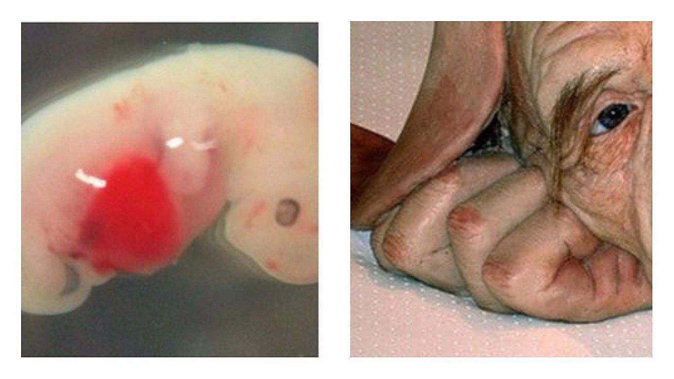 Científicos revelan la verdad detrás de híbrido de ser humano y cerdo