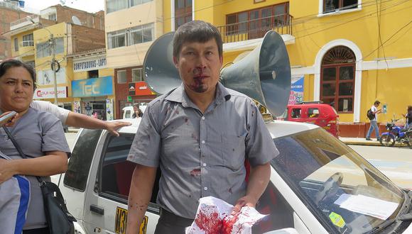 ​Alcalde de Llicua baña en sangre a candidato cuando buscaba votos