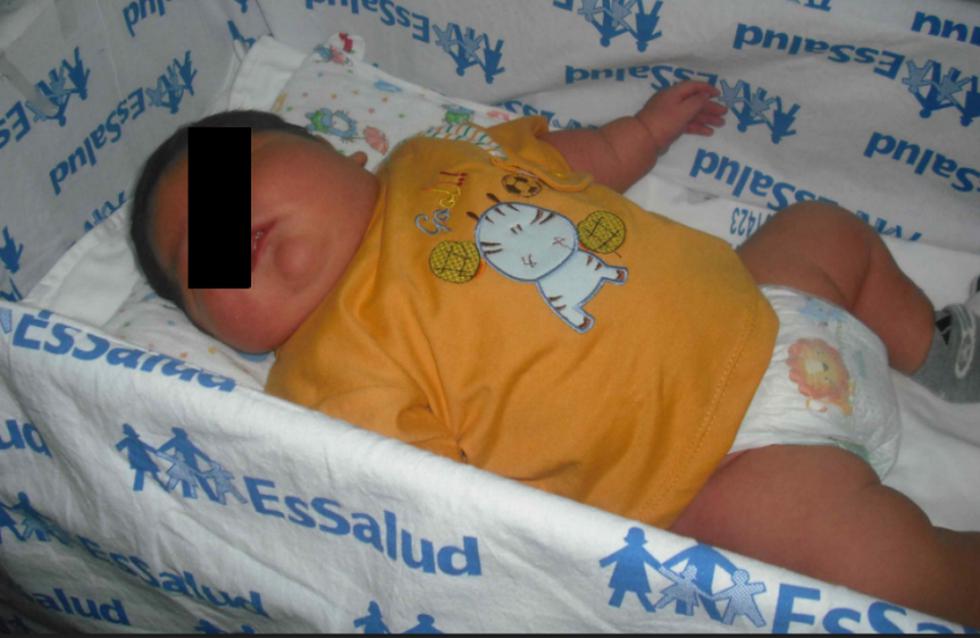 Iquitos: Nace bebé de casi 7 kilos (Fotos)