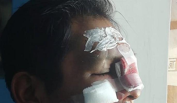 Decano del Colegio de Ingenieros fue brutalmente agredido 