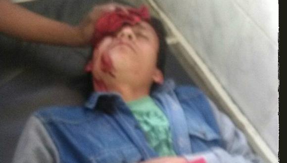 Trujillo: Serenos auxilian a joven que terminó con la ceja rota 
