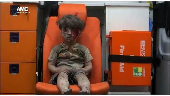 Siria: La imagen de un niño herido llama la atención sobre el drama de Alepo (VIDEO)