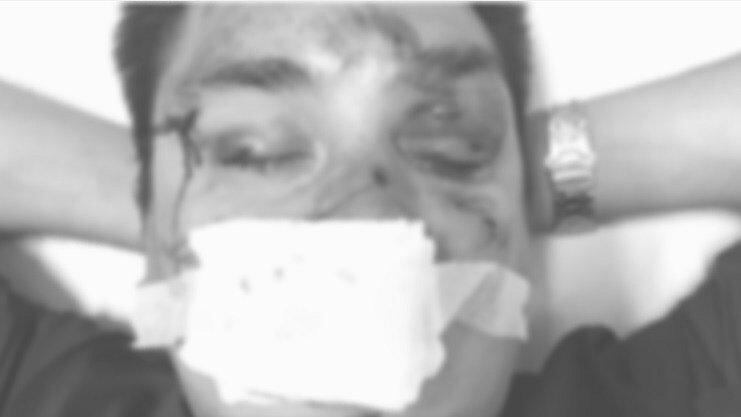 ​Barrabravas de Racing agredieron brutalmente a periodista