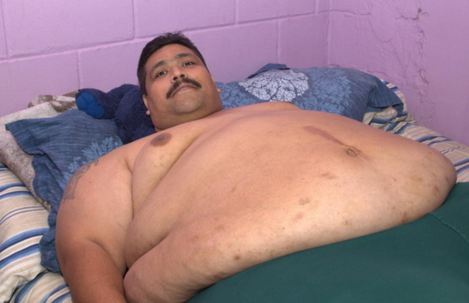 ​A horas de ser operado, el hombre más obeso del mundo sueña con vida normal