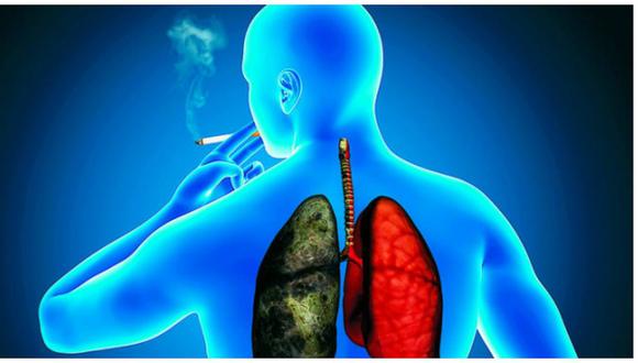 Cáncer de pulmón cuesta 1,35 billones de dólares anuales a América Latina