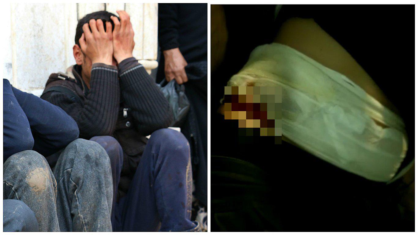 Refugiado sirio tuvo que vender su riñón para alimentar a su madre y hermanas (VIDEO)