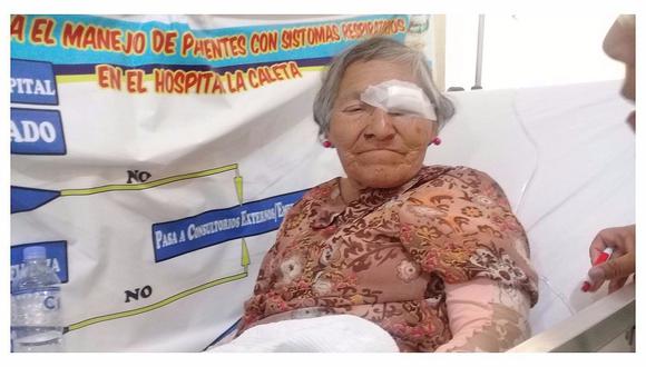 Chimbote: Mujer que sufre problemas mentales fue atropellada y necesita ayuda para recuperarse 