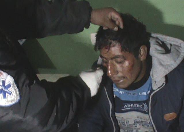 Ladrones envenenan perros para atacar a una familia en Juliaca