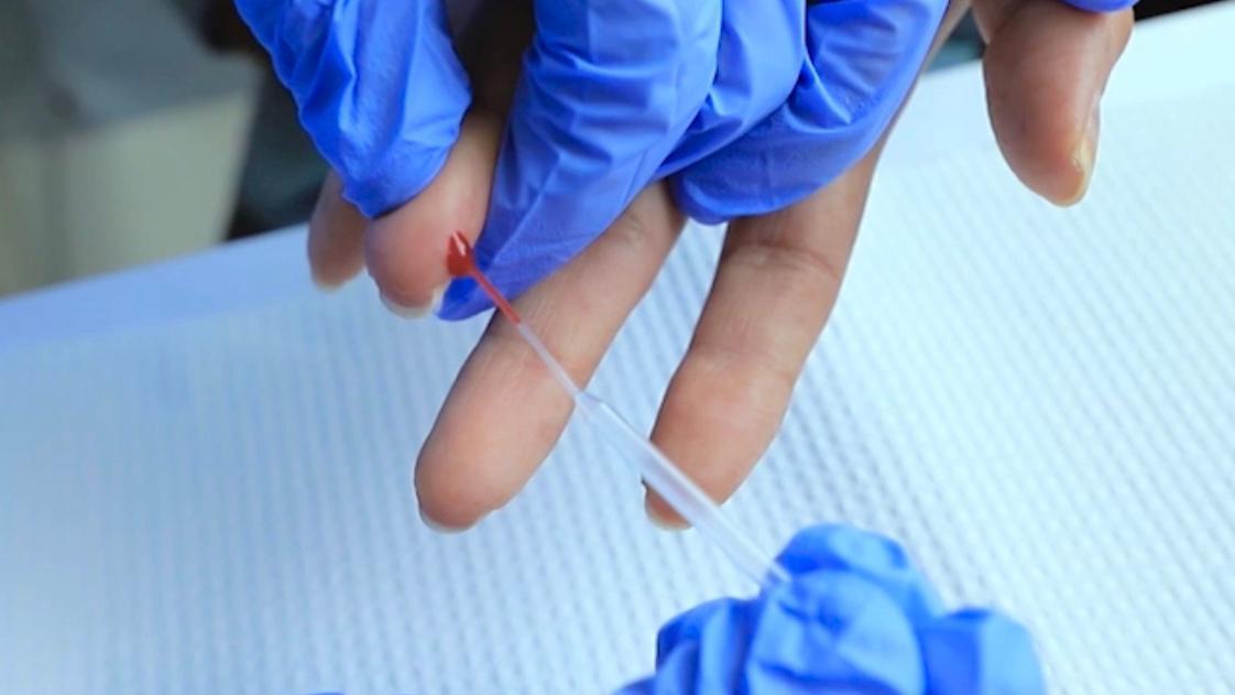 Los resultados obtenidos mediante las pruebas rápidas deben ser reportados a la autoridad sanitaria. (MINSA)