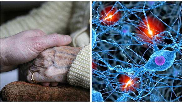 Alzheimer: Reactivar las ondas cerebrales puede favorecer lucha contra enfermedad