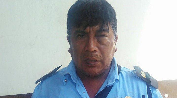 Menor agrede a un agente de Seguridad Ciudadana 