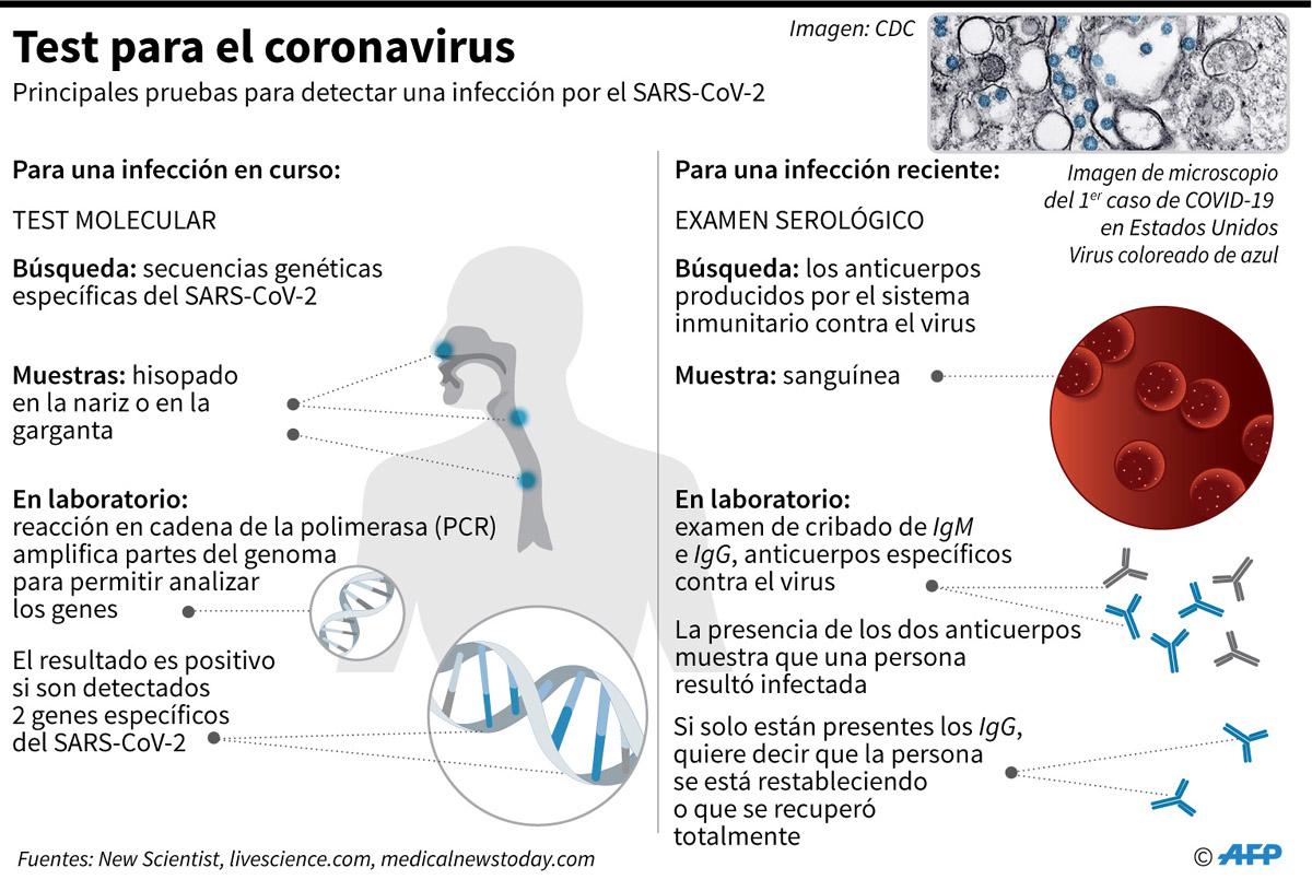 Gráfico que muestra los métodos de test para la epidemia del nuevo coronavirus. (Infografía: AFP)