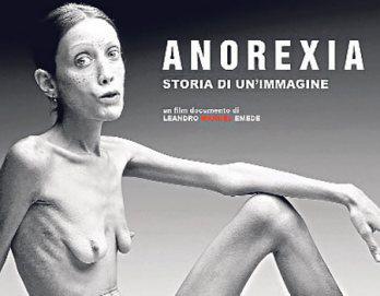 Falleció modelo anoréxica