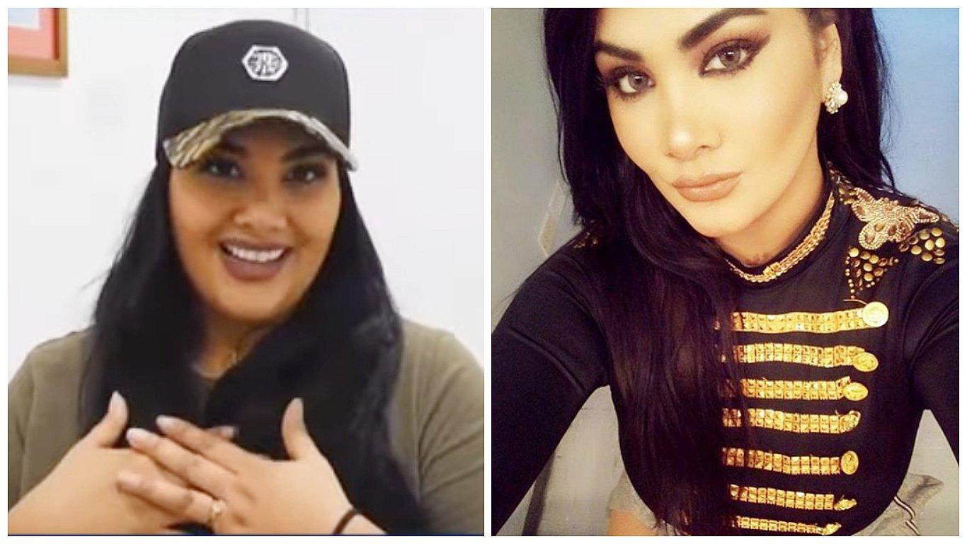 Chris Soifer se sometió a operación para bajar de peso: "Estaba en un estado pre diabético" (VIDEO)