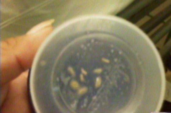 Gusanos invadieron oído de niña de 10 años 