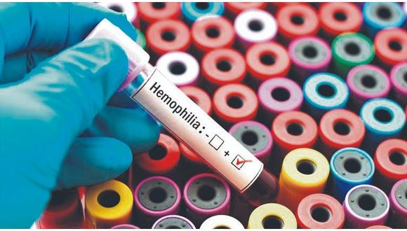 Hemofilia: conoce todo sobre este mal que no permite que la sangre coagule