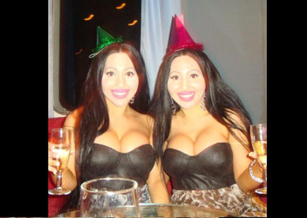 Gemelas se operan para ser idénticas y compartir novio