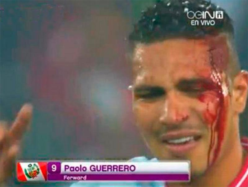Paolo Guerrero sufrió corte en la cabeza en el Perú - Uruguay (VIDEO)
