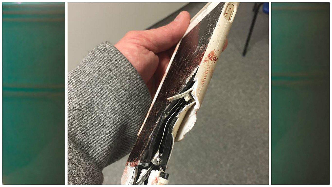 Facebook: su iPhone le salvó la vida en atentado de Manchester pero perdió parte del cuerpo (FOTOS)