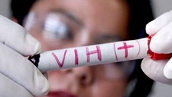 Identifican 49 nuevos casos de VIH en la región de Tacna