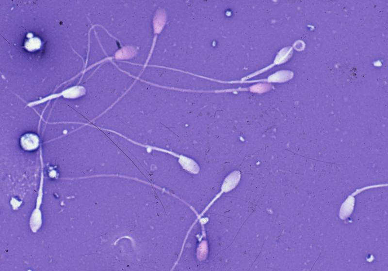 Propiedades del semen que no conocías