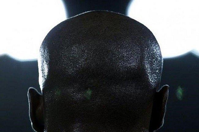 ​¡Insólito! Matan a cinco personas con calvicie porque pensaban que tenían oro en la cabeza