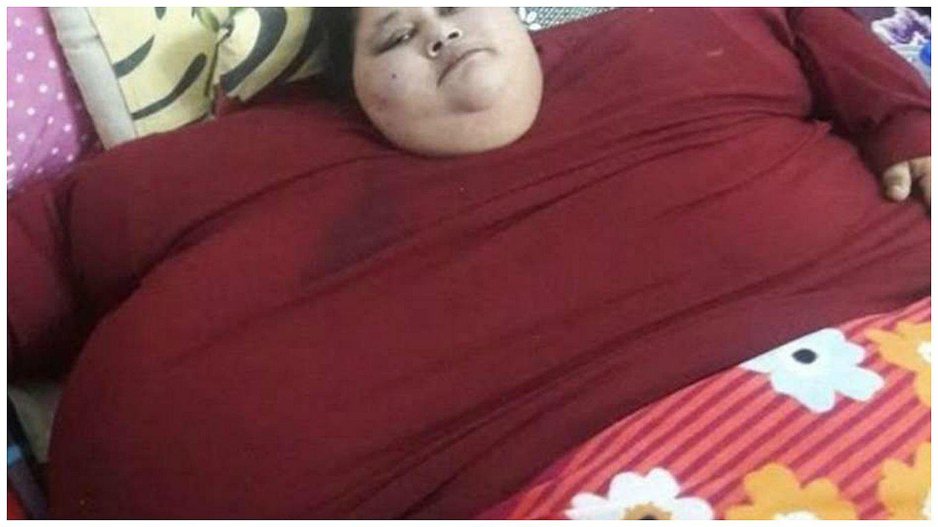 Así luce la mujer más obesa del mundo tras perder 240 kilos [FOTOS]